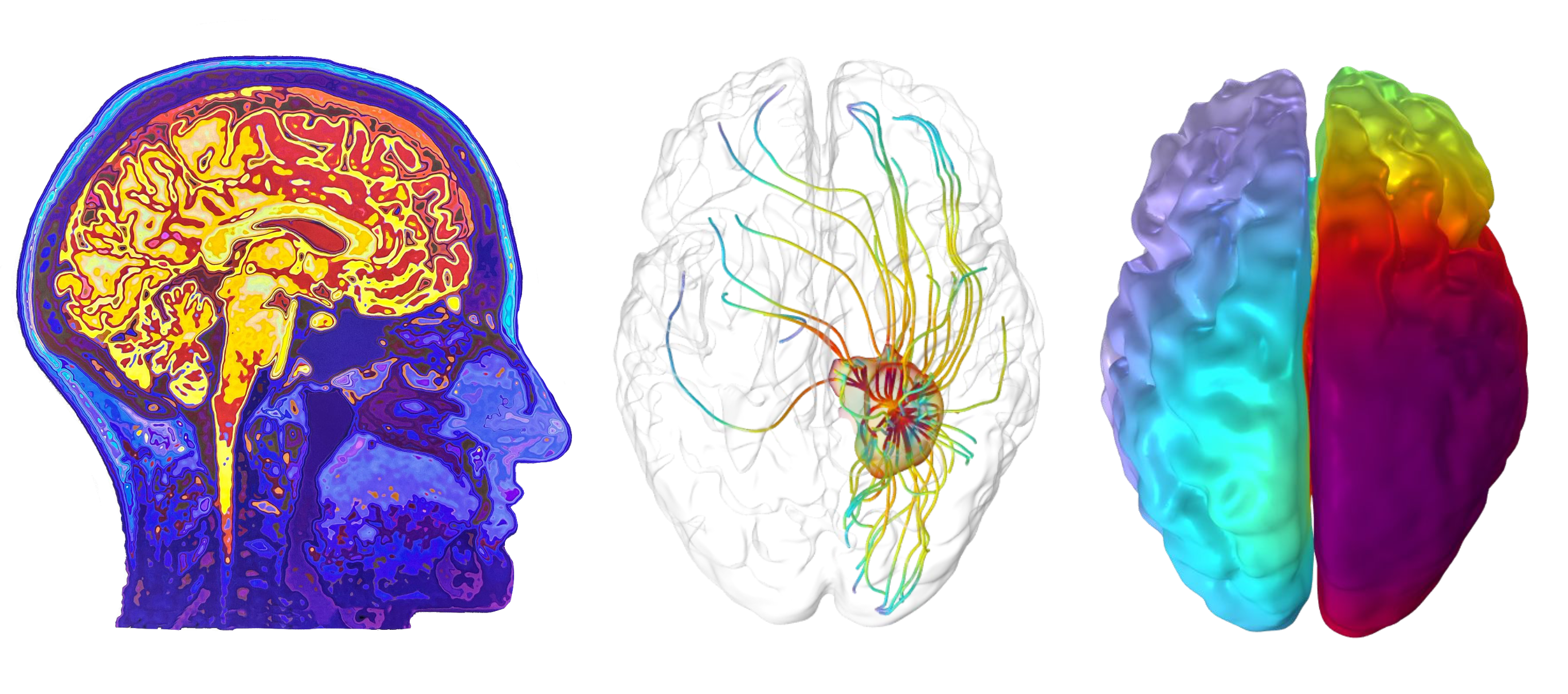 MRI-informed mathematical modelling of tumour transport